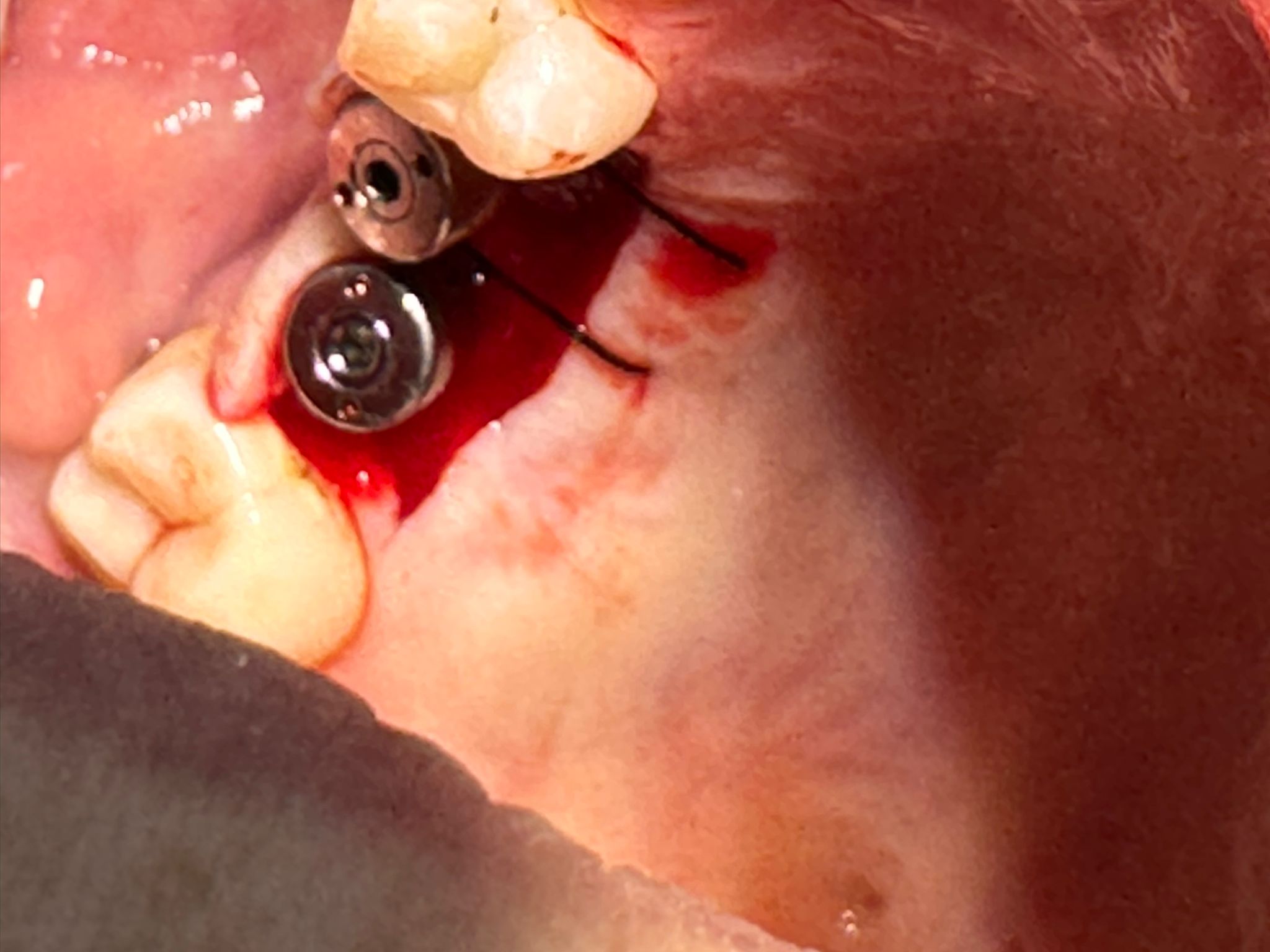 Prévention des maladies parodontales à Témara