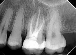 Consultation dentaire préventive à Témara