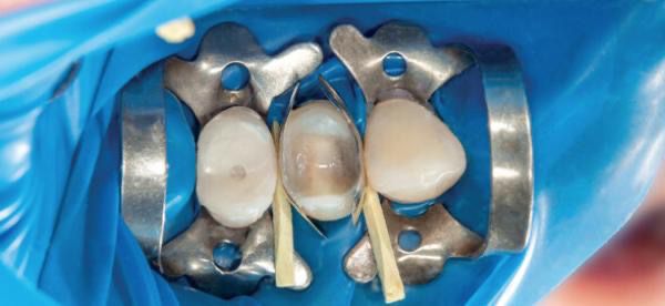 Équipe soignante et matériel de pointe en dentisterie